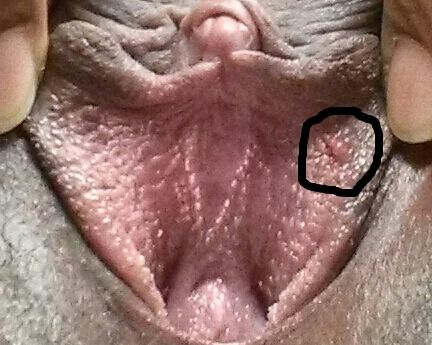 short young teen ready for action girls with hpv lips